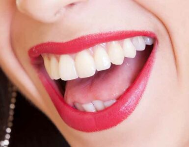 La importancia de la ortodoncia para los jóvenes - Apréndete Mujer con amplia sonrisa, labios rojos y dientes blancos y alineados.